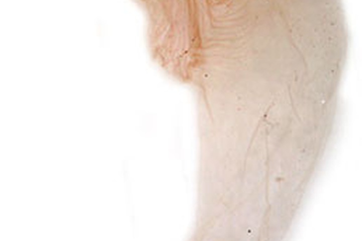 /filer/webapps/moths/media/images/A/aethiopica_Abrostola_GF_Dufay_Bx2_uymUPH5.jpg