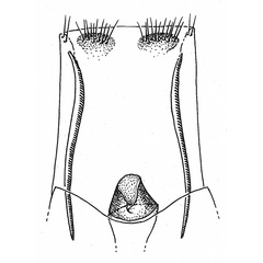 /filer/webapps/moths/media/images/K/kenyacola_Digitivalva_GF_Gaedike.jpg