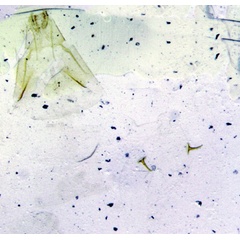 /filer/webapps/moths/media/images/S/spissana_Grapholita_GFHT_SNHM-2102.jpg
