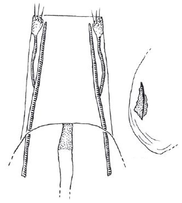 /filer/webapps/moths/media/images/B/bulbosa_Epermenia_GF_RMCA.jpg