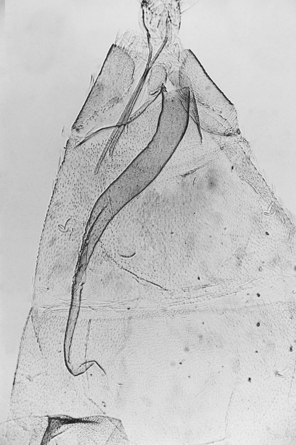 /filer/webapps/moths/media/images/F/fulva_Platyptilia_GFPT_MNHN_M35.jpg